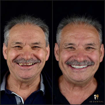 Slider image (8) A2 Dental: Premier Dental Clinic in Croatia